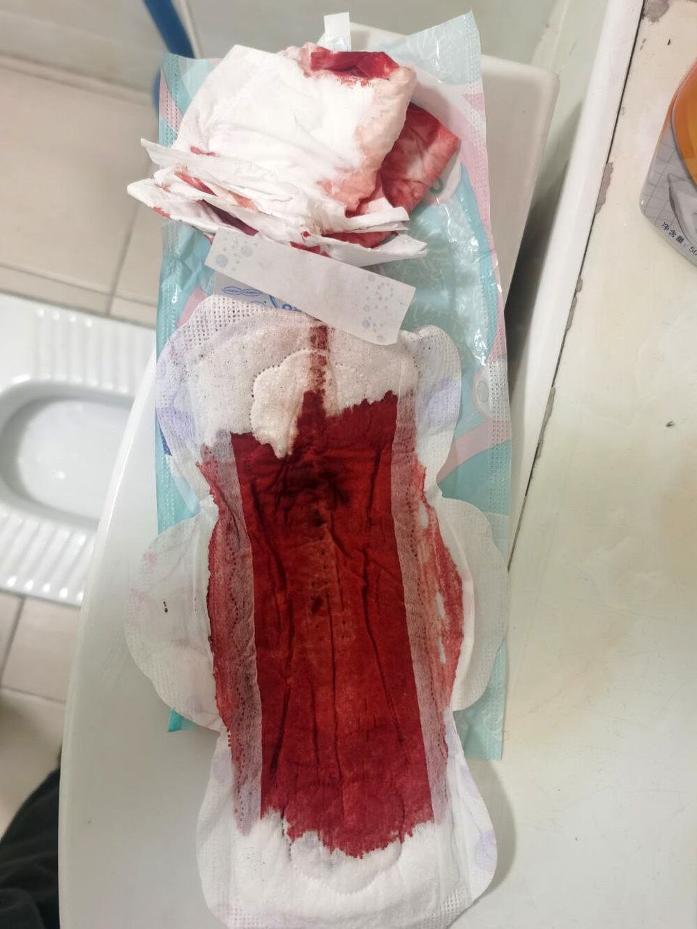 2022-01-08 Used gaskets and menstruation (part 78) [Menstruation, Tampons, Pads, Period, Blood] [1000 * 750 to 4752 * 3168, 500 photos] – Porn torrents download