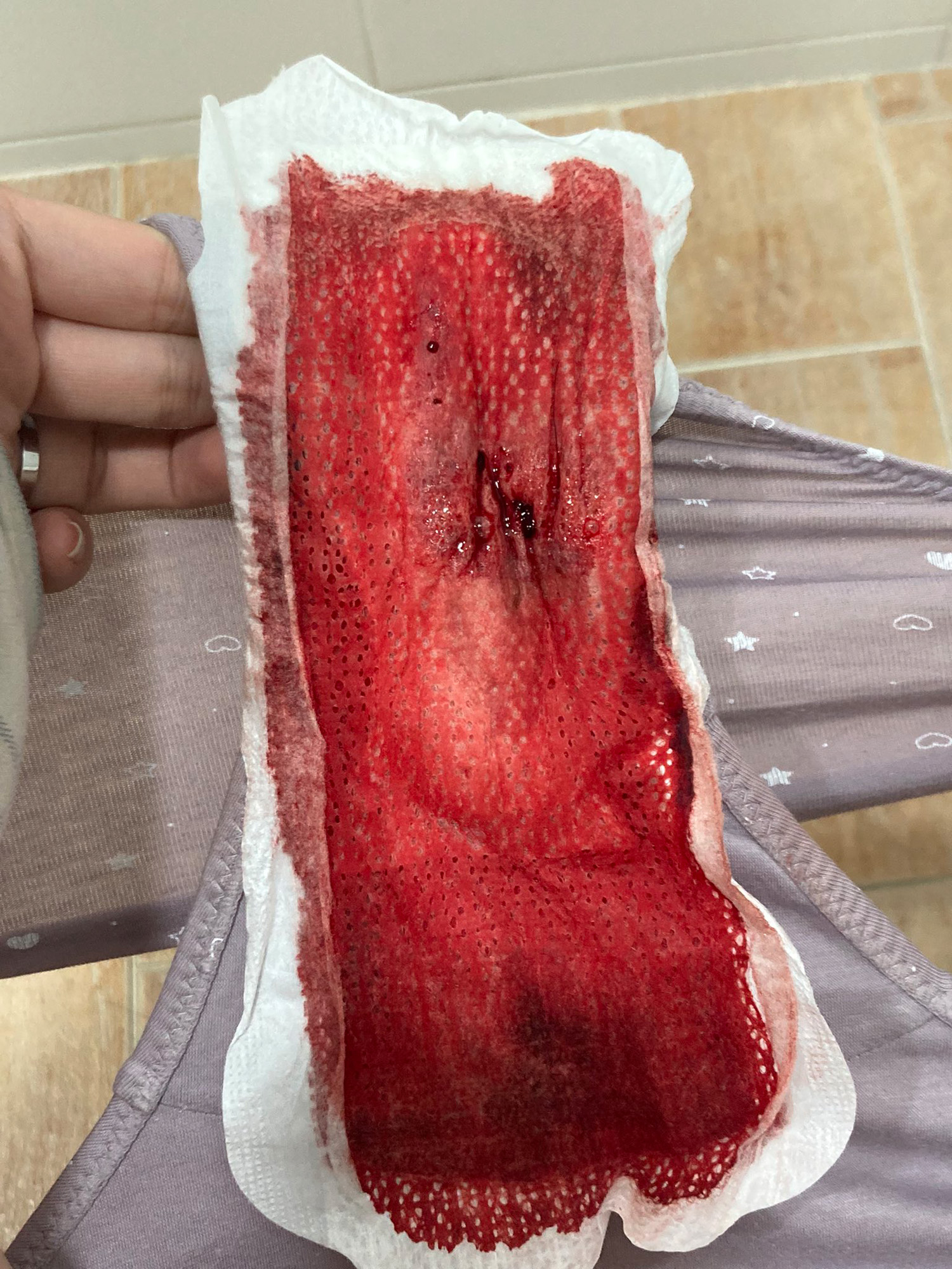 2022-05-12 used gaskets and menstruation (part 81) [MENSTRUATION, TAMPONS, PADS, Period, Blood] [1000*750 to 4752*3168, 500 photos] – Porn torrents download