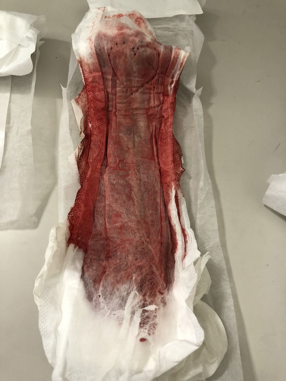 2022-09-01 Used gaskets and menstruation (part 84) [MENSTRUATION, TAMPONS, PADS, Period, Blood] [1000*750 to 4752*3168, 500 photos] – Porn torrents download