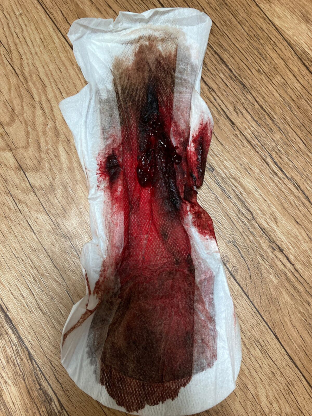 2022-10-08 Used gaskets and menstruation (part 85) [MENSTRUATION, TAMPONS, PADS, Period, Blood] [1000*750 to 4752*3168, 500 photos] – Porn torrents download