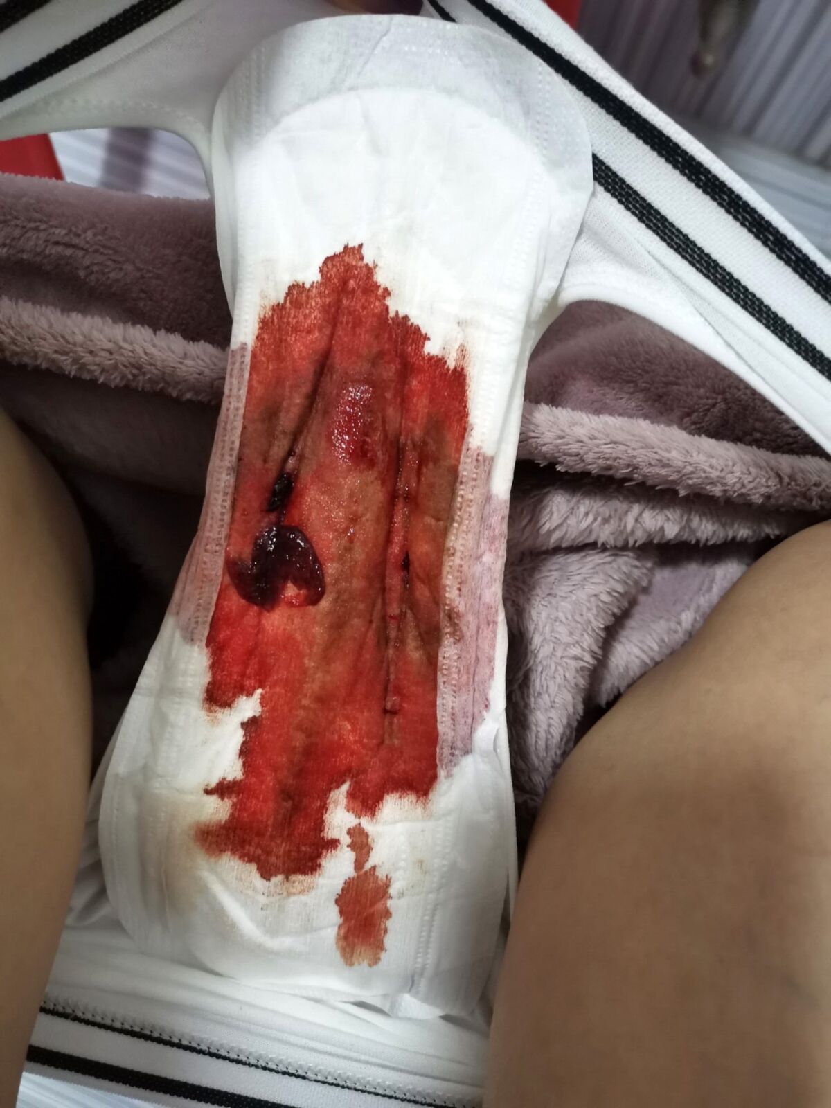 2022-12-07 Used gaskets and menstruation (part 88) [MENSTRUATION, TAMPONS, PADS, Period, Blood] [1000*750 to 4752*3168, 500 photos] – Porn torrents download